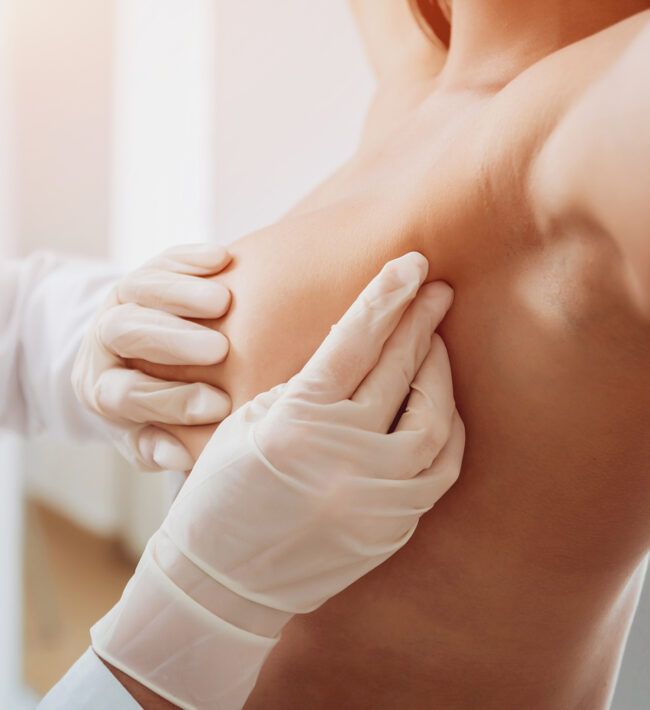 Benefits of breast reduction surgery