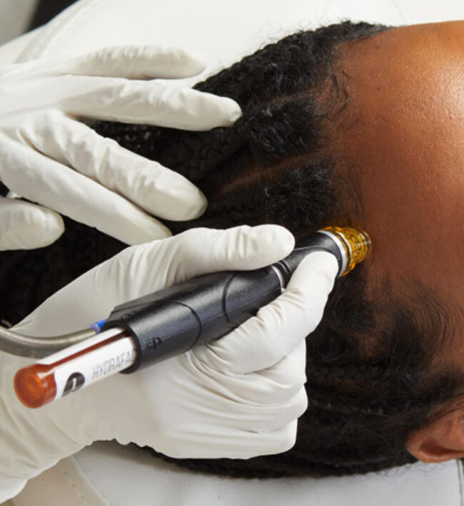 Vortex Fusion Technology and Hydropeel Tips