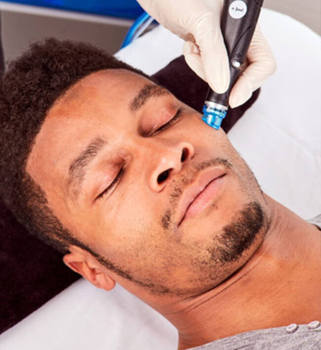 Hydrafacial System